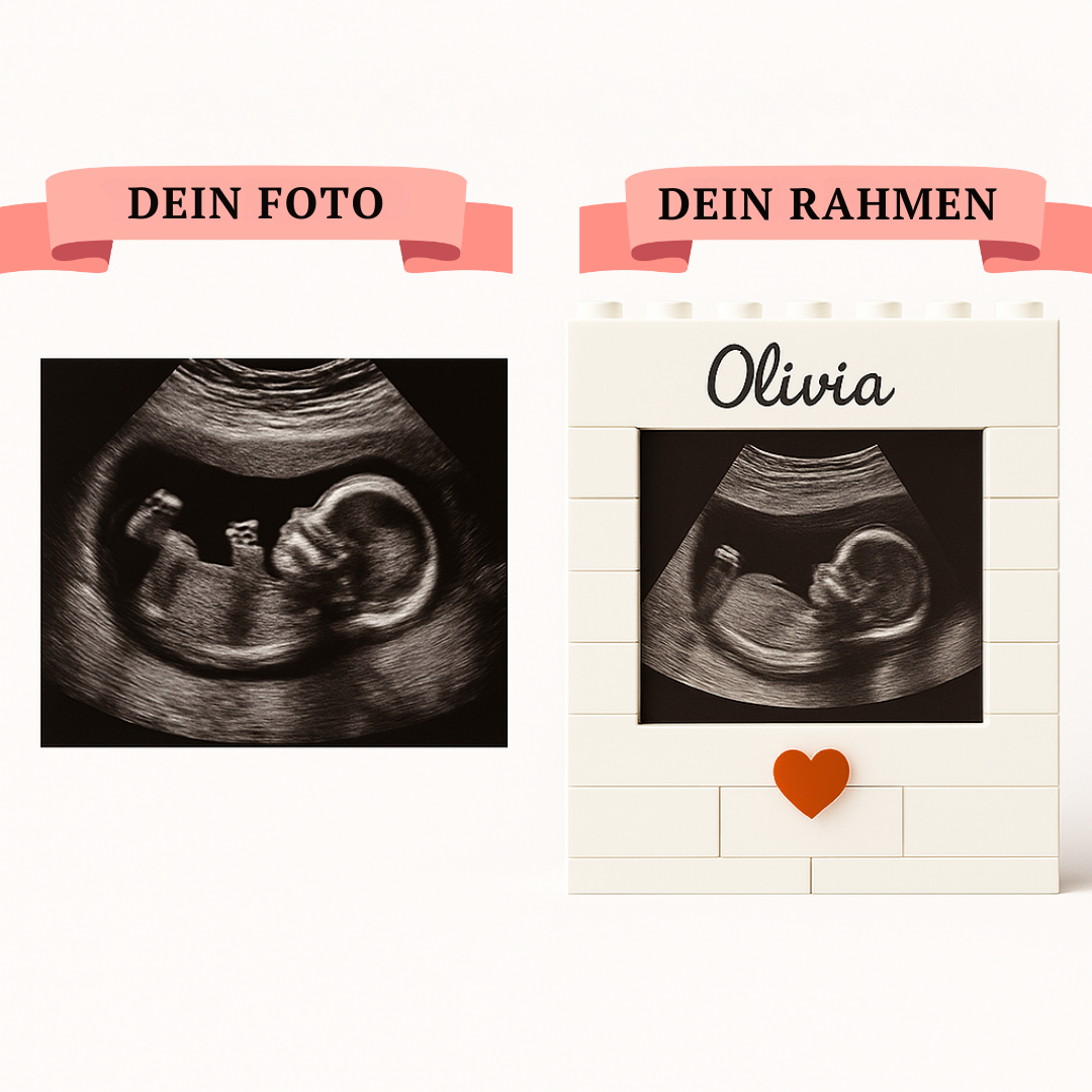 Personalisierter Ultraschall-Baustein-Satz