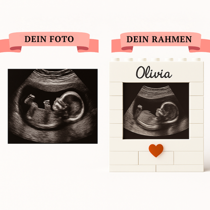 Personalisierter Ultraschall-Baustein-Satz